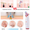 Diamond SkinClear 3 blackhead remover supporting a smoother-looking skin surface
