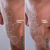 Compact dermaplaning tool suitable for at-home skincare routines