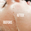 Sonic facial exfoliation tool designed for smooth gliding over the skin
