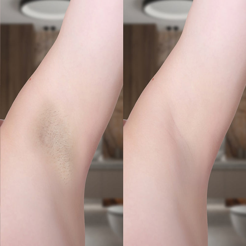 Lumi IPL Hair Remover