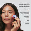DermaClear Anti-Acne Device