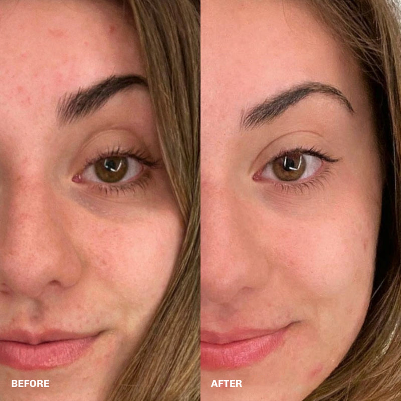 Anti-ageing retinal serum formulated to reduce the appearance of fine lines and uneven texture