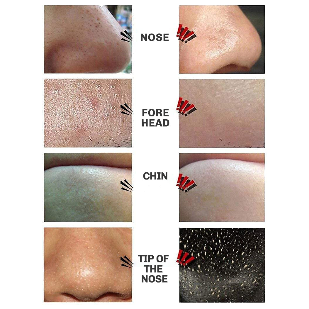 Blackhead Peel-Off Mask