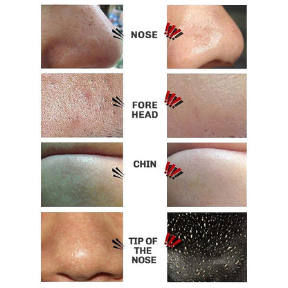 Blackhead Peel-Off Mask