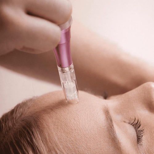 DermaExpert Microneedling Pen 2.0