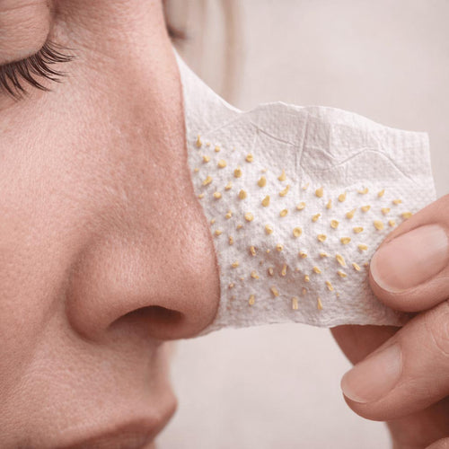 Blackhead Remover Cream