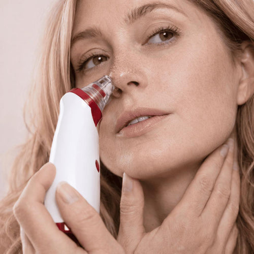 SkinClear 3 Blackhead Remover