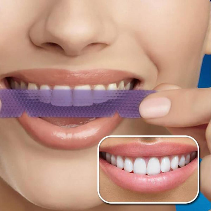 Application and results of tooth whitening strips for home whitening