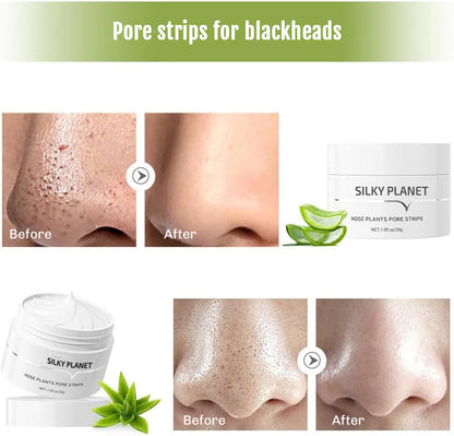 Blackhead Remover Cream