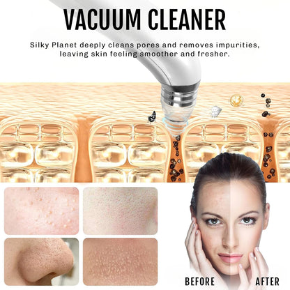 Blackhead Removal Kit