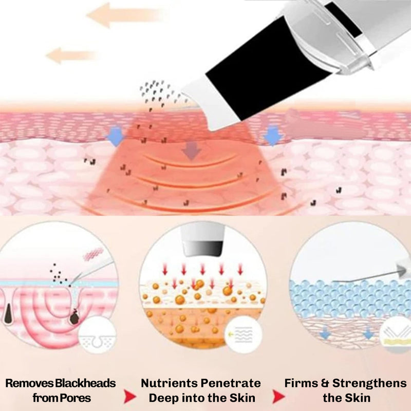 Ultrasonic skin device designed to support skin firmness and renewal