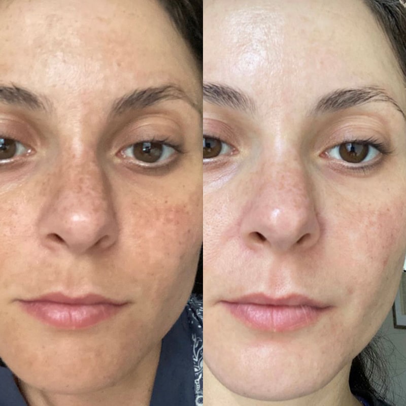 Diamond collagen lifting cream for improved elasticity and natural glow