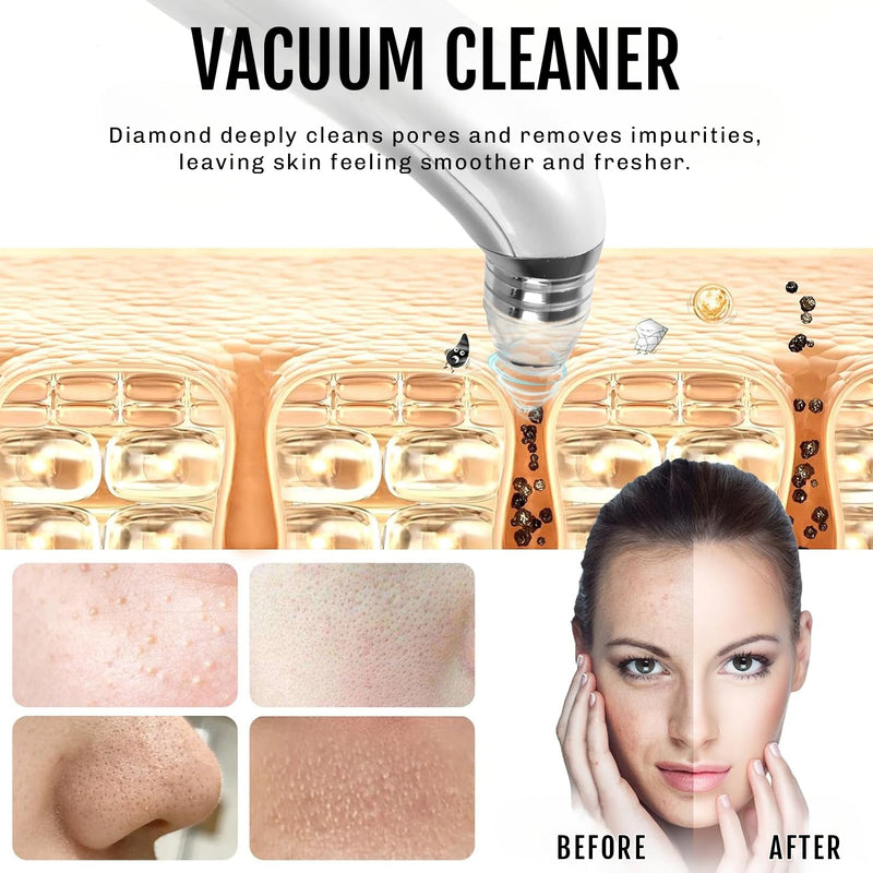 Blackhead remover tool with multiple heads for customised use