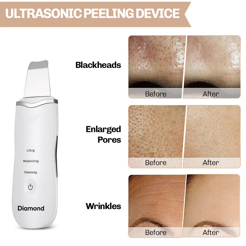 Ultrasonic exfoliating device suitable for sensitive skin