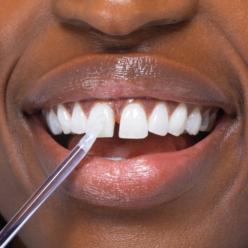 Woman with white teeth applying the Diamond Smile Bleaching Glow Stick