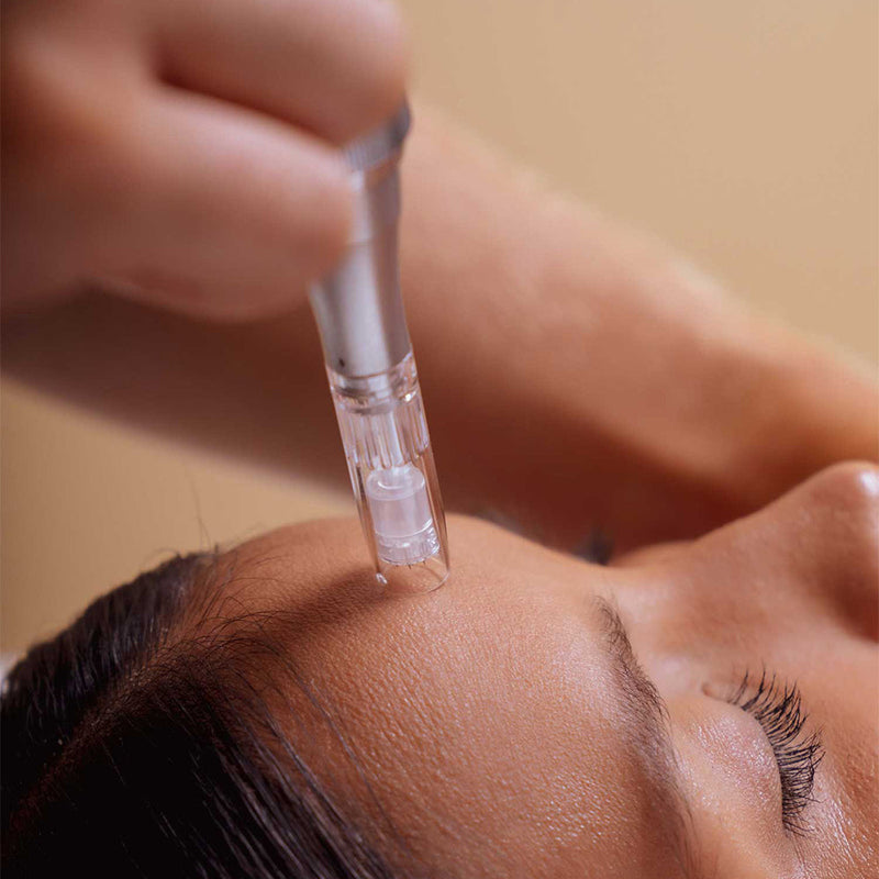 DermaExpert Microneedling Pen 2.0
