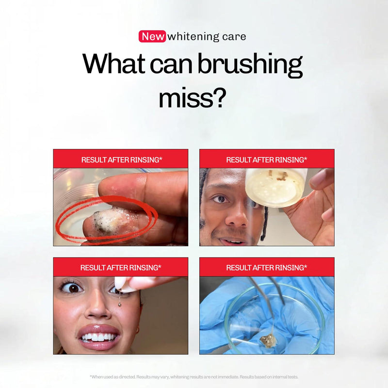 Whitening Mouthwash iD+