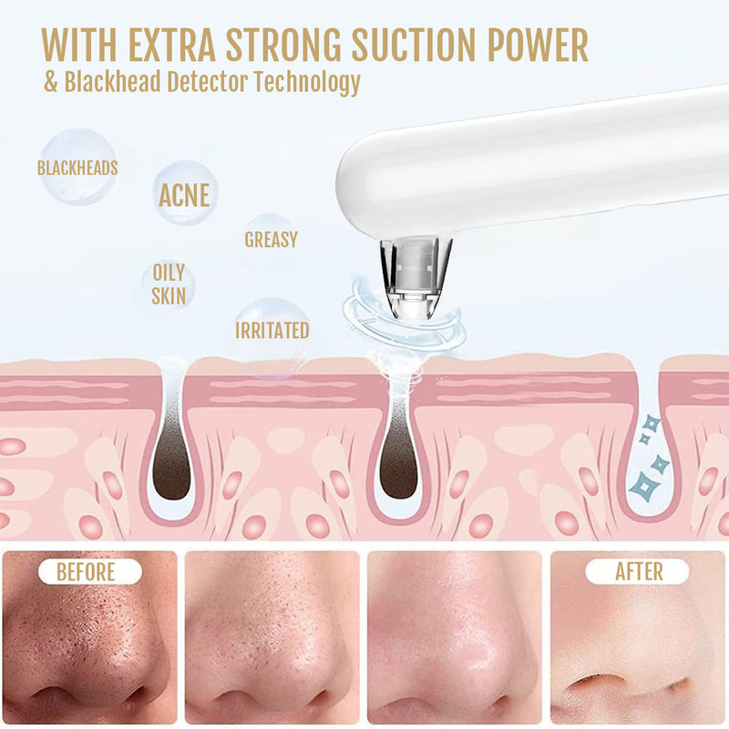 Blackhead removal kit designed to support smooth and even-looking skin