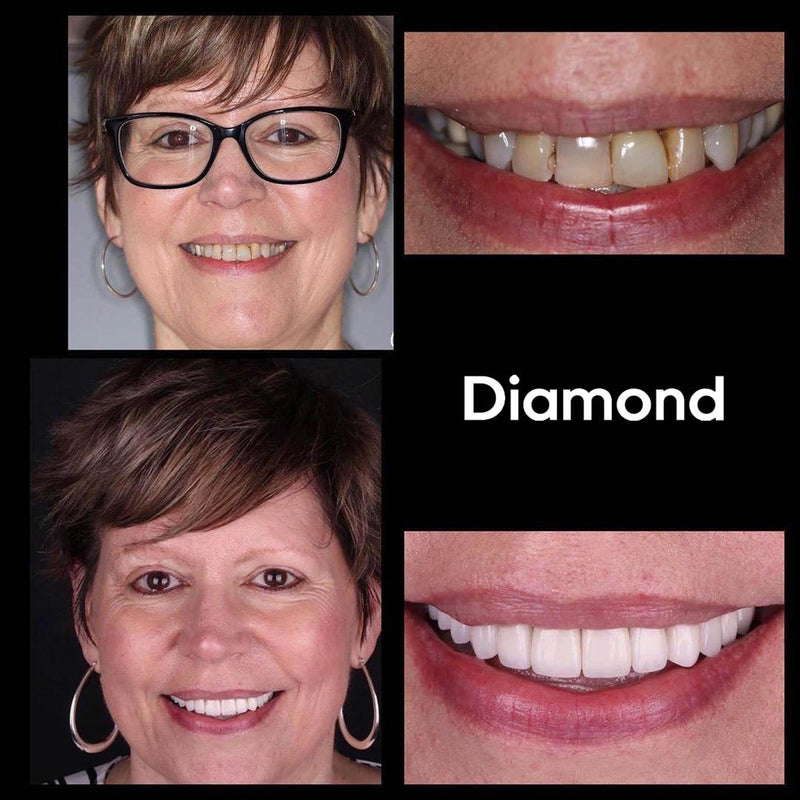 Whitening Mouthwash iD+