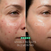 LED mask for brighter smoother and healthier looking skin