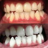 Tooth whitening foam for whitening teeth