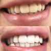 Teeth whitening Color Correction Foam