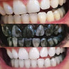 Experience of Diamond Smile tooth whitening activated charcoal powder - mouth with before and after picture of white teeth